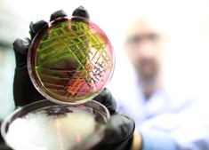 戴手套的微生物实验室技术员手持涂有大肠杆菌的培养基平板